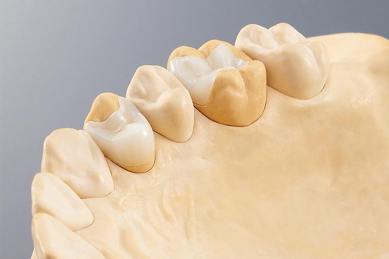 Fresadora Dental CAD CAM